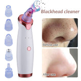 Blackhead Vacuum